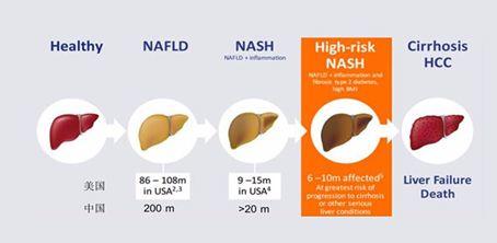 综述 | NASH主要靶点新药动物和临床研究进展