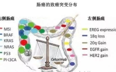 结直肠癌的化疗、靶向疗法、免疫疗法与“边际”效应
