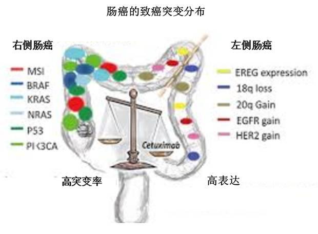 结直肠癌的化疗、靶向疗法、免疫疗法与“边际”效应