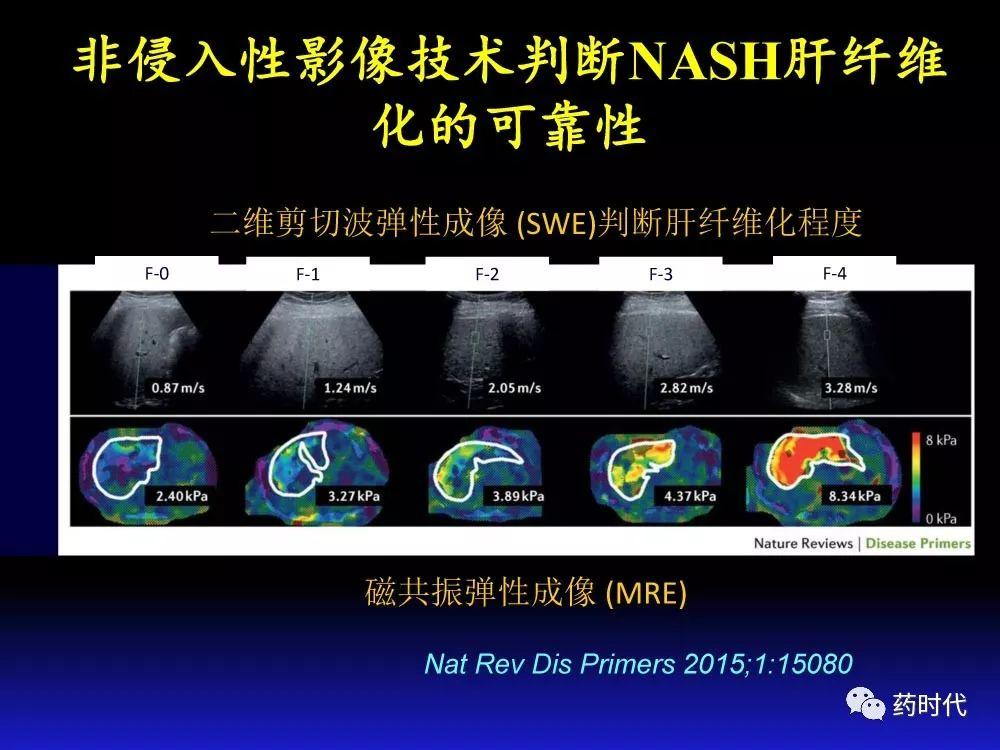 吴健教授 | NASH肝纤维的分子机制及干预靶点