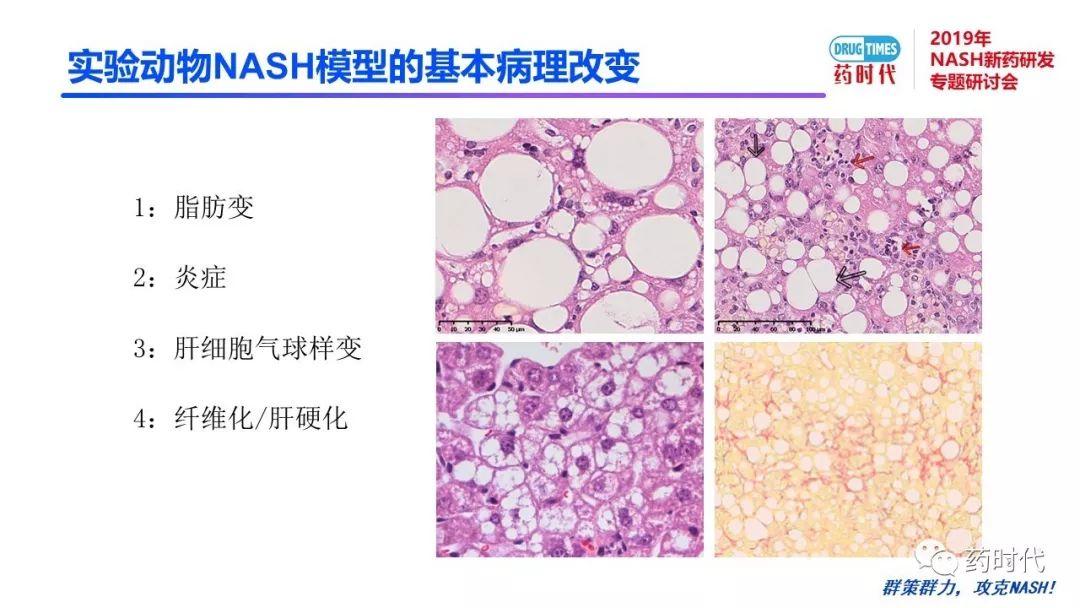 庄永傑博士 | NASH新药研发相关试验动物模型的分析