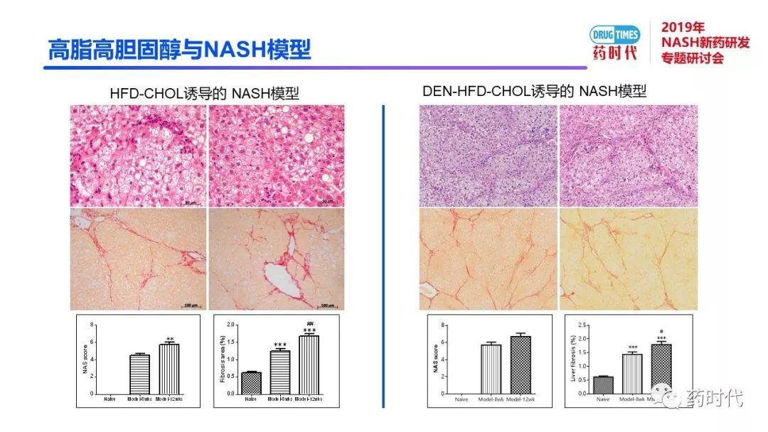 庄永傑博士 | NASH新药研发相关试验动物模型的分析