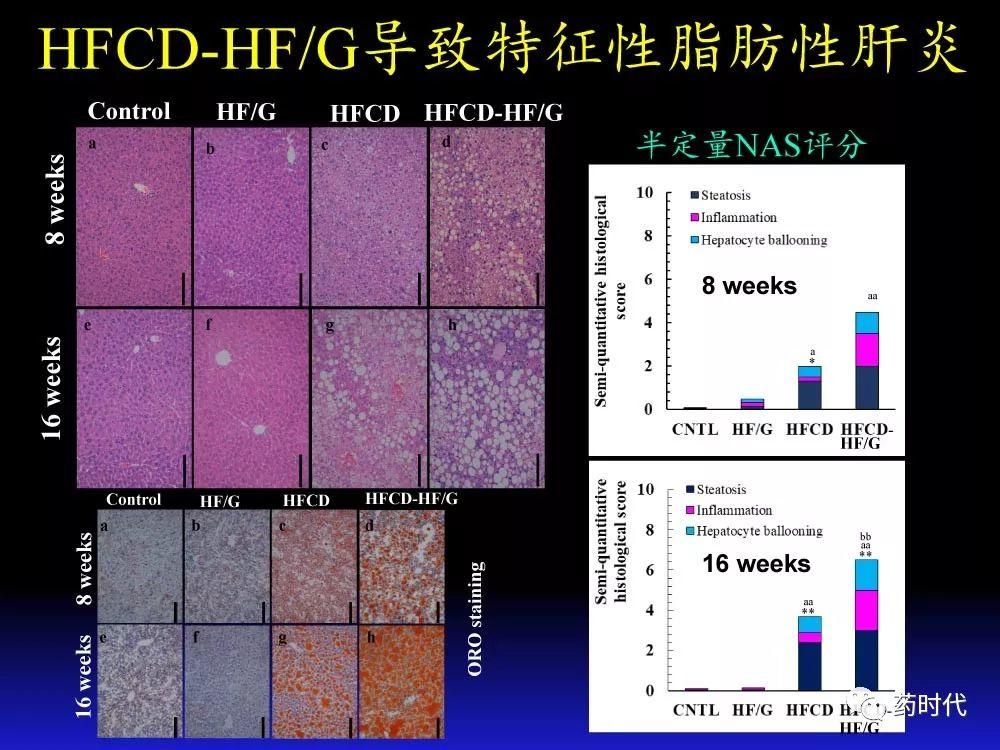 吴健教授 | NASH肝纤维的分子机制及干预靶点