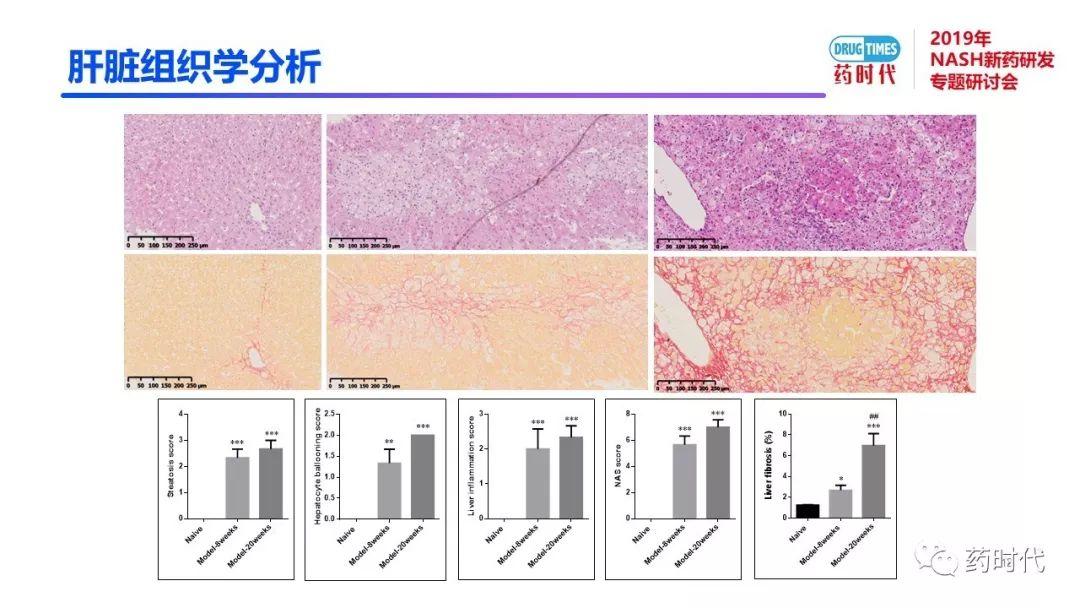 庄永傑博士 | NASH新药研发相关试验动物模型的分析
