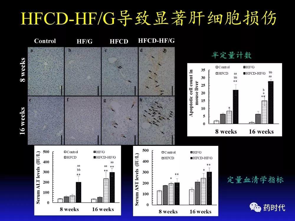 吴健教授 | NASH肝纤维的分子机制及干预靶点