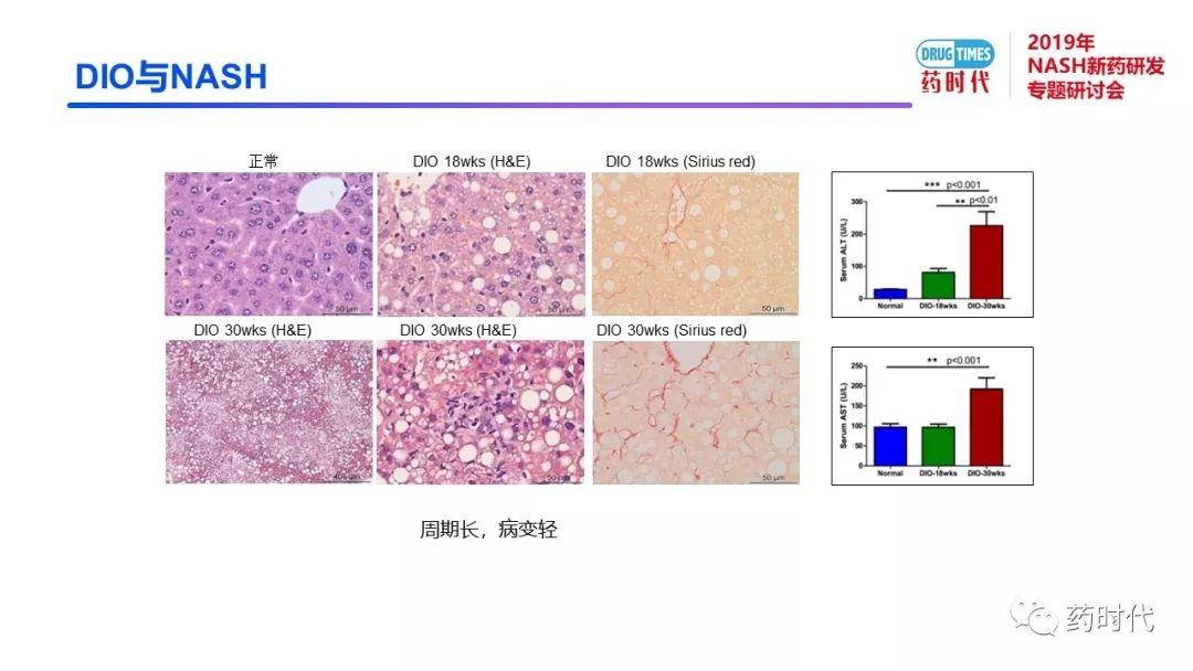 庄永傑博士 | NASH新药研发相关试验动物模型的分析