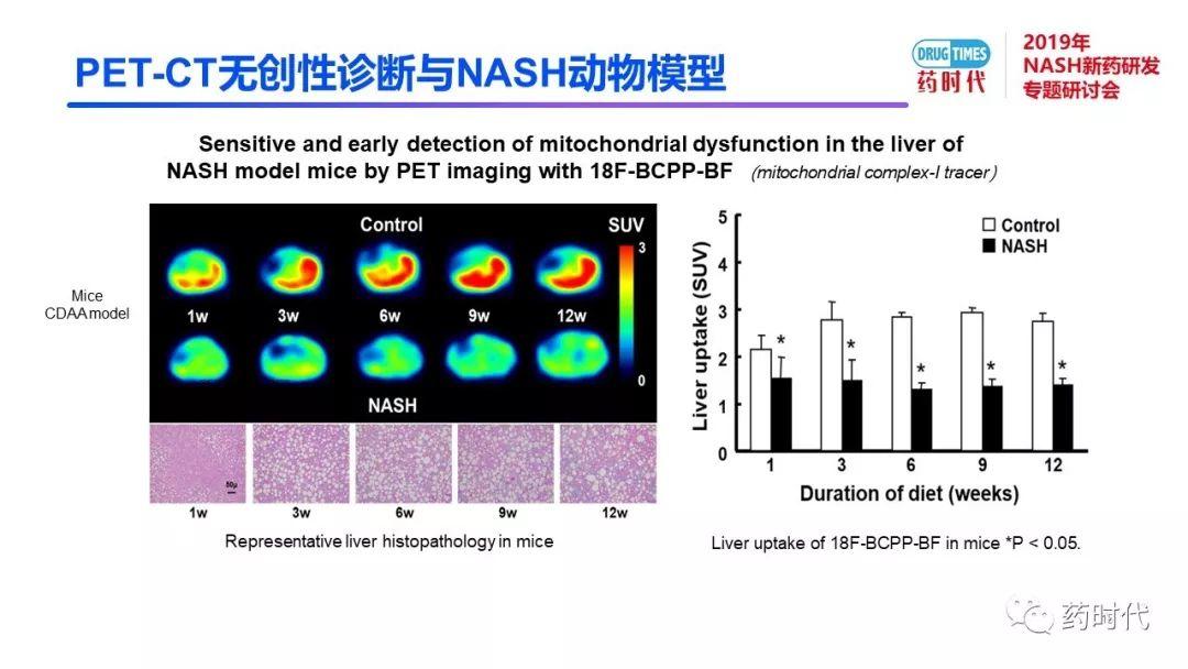 庄永傑博士 | NASH新药研发相关试验动物模型的分析