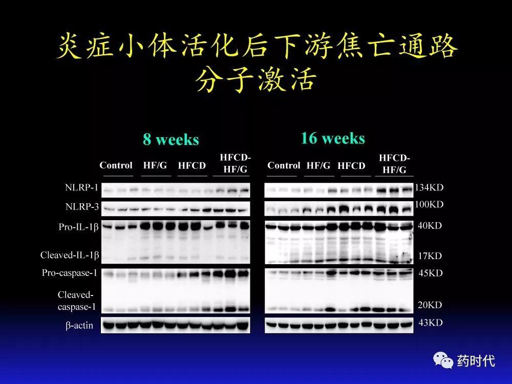 吴健教授 | NASH肝纤维的分子机制及干预靶点