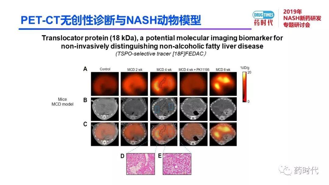 庄永傑博士 | NASH新药研发相关试验动物模型的分析