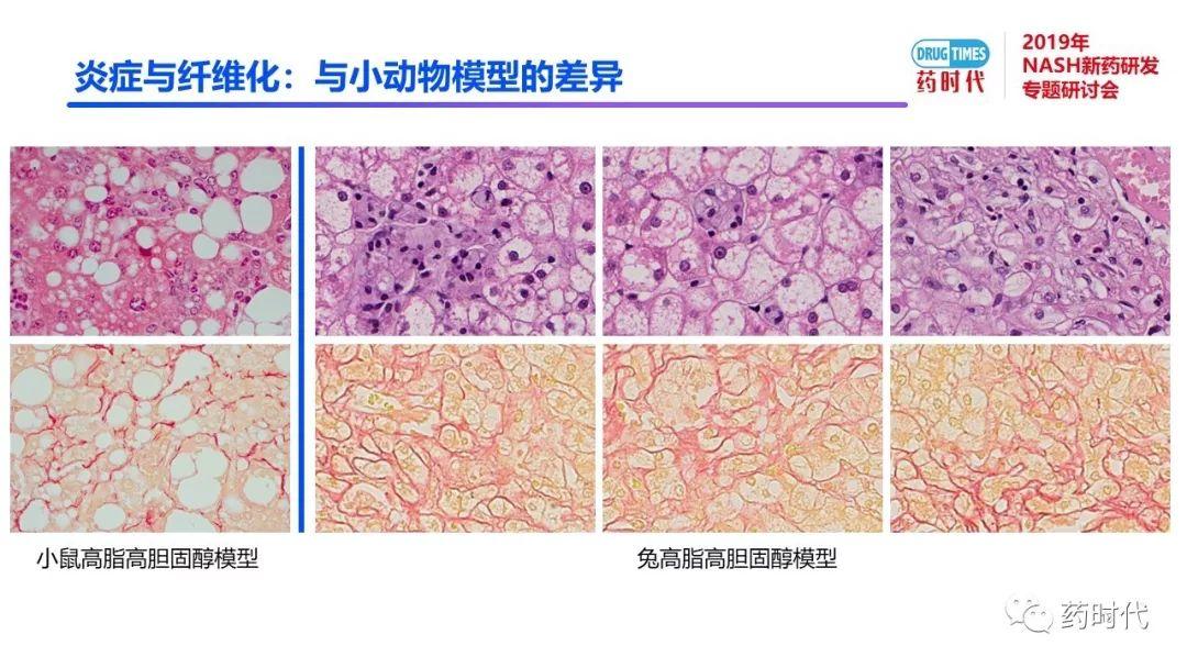 庄永傑博士 | NASH新药研发相关试验动物模型的分析