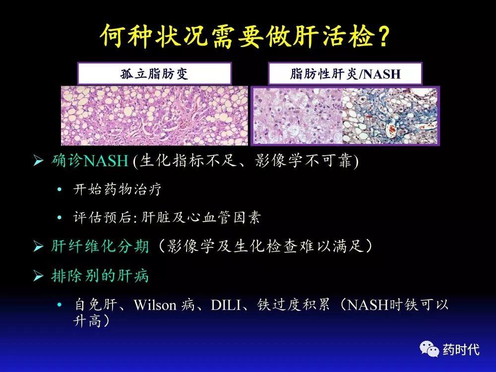 吴健教授 | NASH肝纤维的分子机制及干预靶点