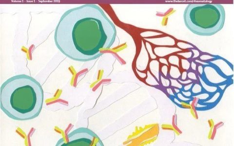 再出佳绩！信达生物IBI303在强直性脊柱炎患者中Ⅲ期关键研究结果荣登《柳叶刀•风湿病学》