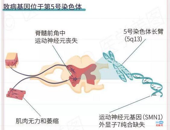 挽救Smart Marvelous Angel的第一小分子