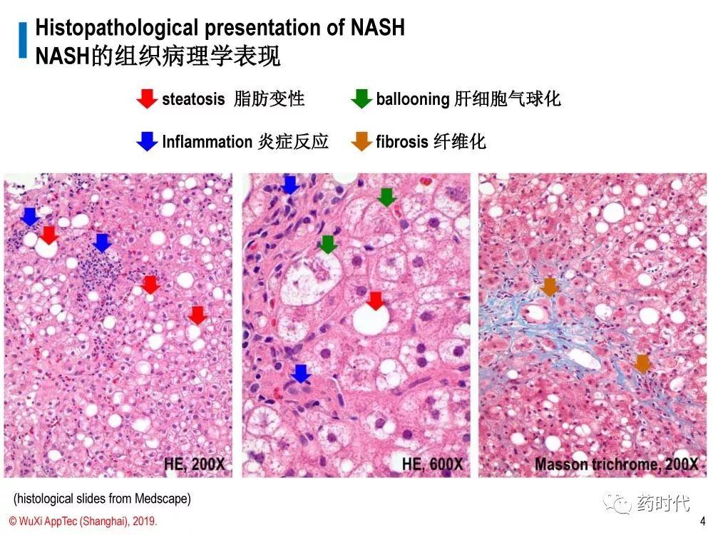 徐德鸣博士 | NASH动物模型的策略：现有模型都不足，但有用