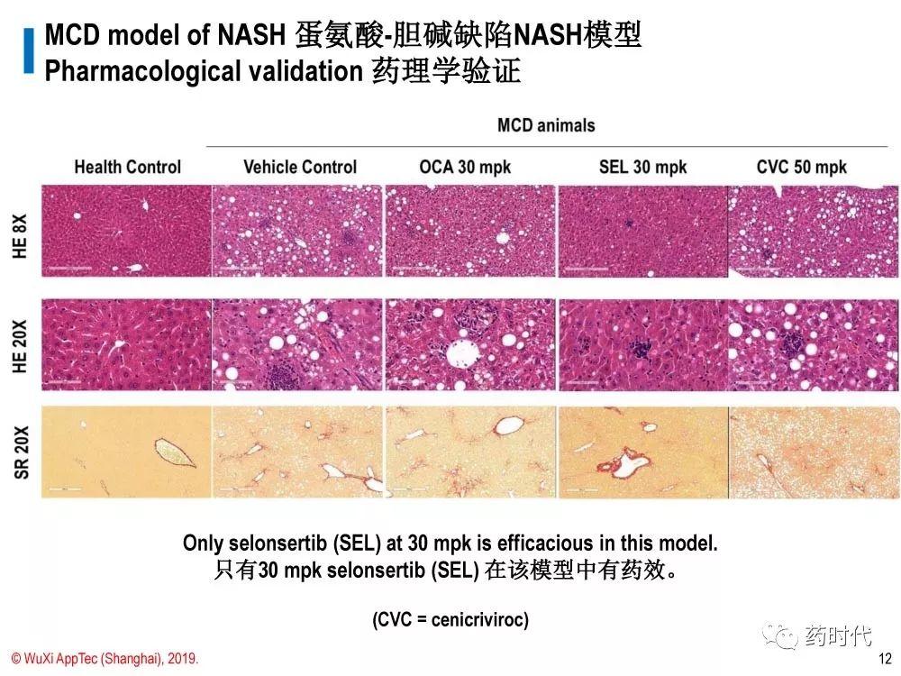 徐德鸣博士 | NASH动物模型的策略：现有模型都不足，但有用