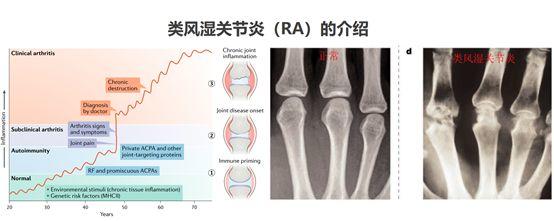 全新MOA的阿巴西普即将在中国登陆