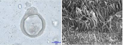 创芯构建Accuroid™呼吸道粘膜类器官 助力冠状病毒的研究