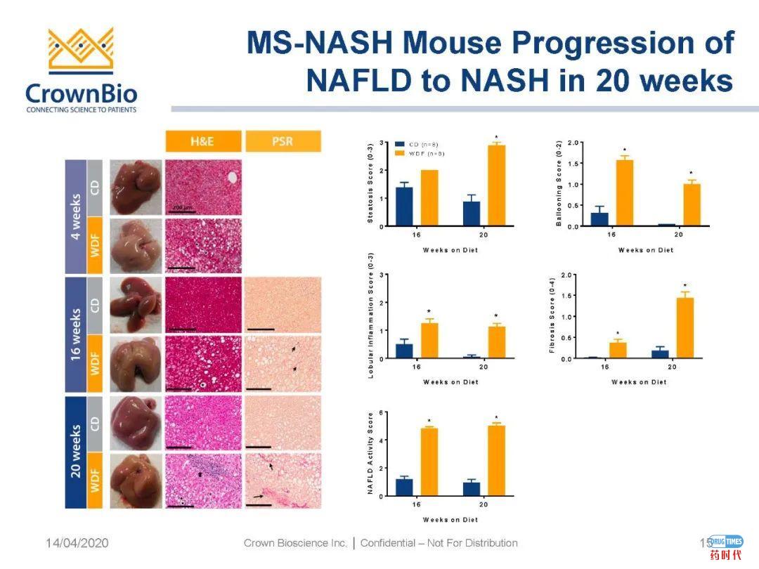 药时代直播间｜“NAFLD/NASH和纤维化转化性临床前动物模型：从啮齿类动物到非人类灵长类动物（NHP）”网络研讨会问题解答