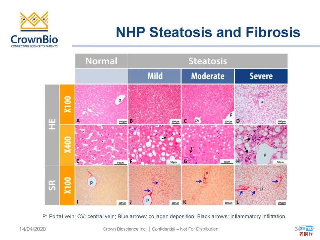 药时代直播间|“NAFLD/NASH和纤维化转化性临床前动物模型:从啮齿类动物到非人类灵长类动物(NHP)”网络研讨会问题解答
