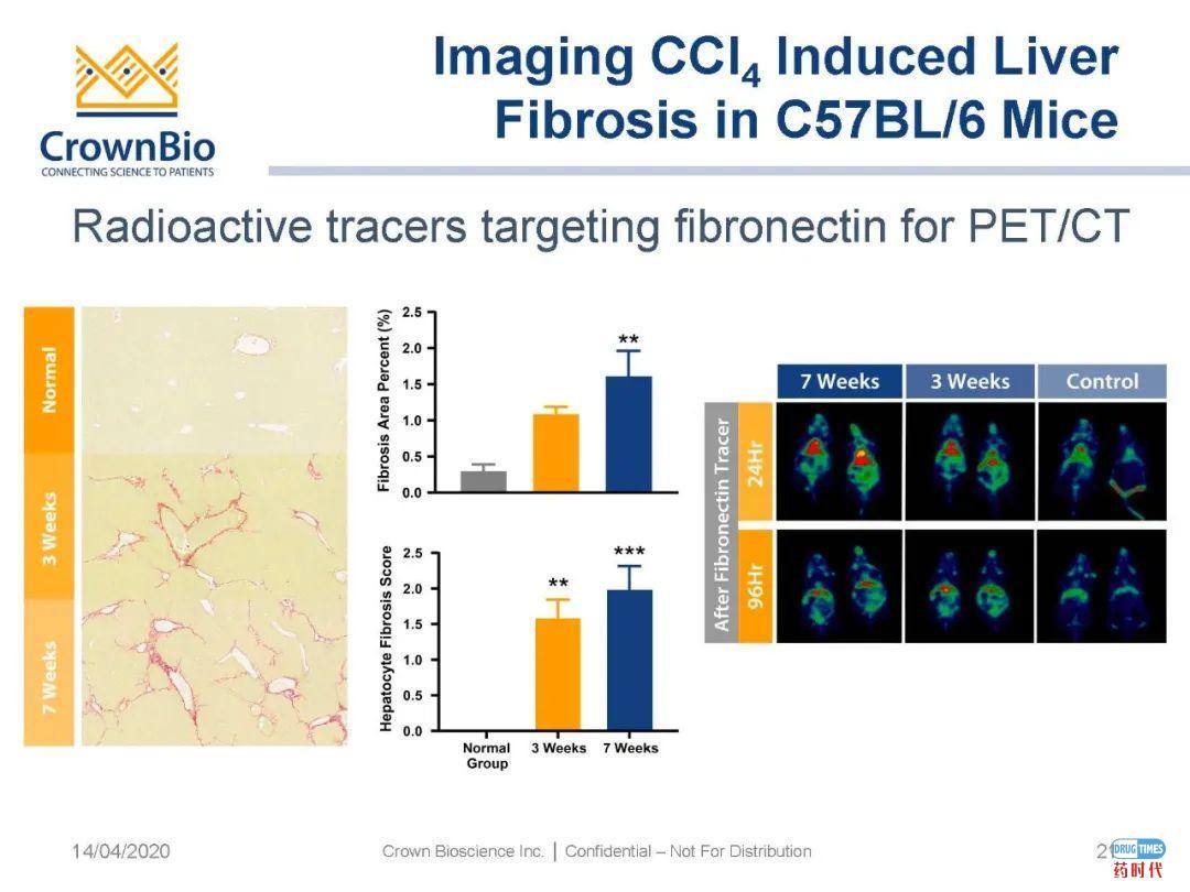 药时代直播间|“NAFLD/NASH和纤维化转化性临床前动物模型:从啮齿类动物到非人类灵长类动物(NHP)”网络研讨会问题解答