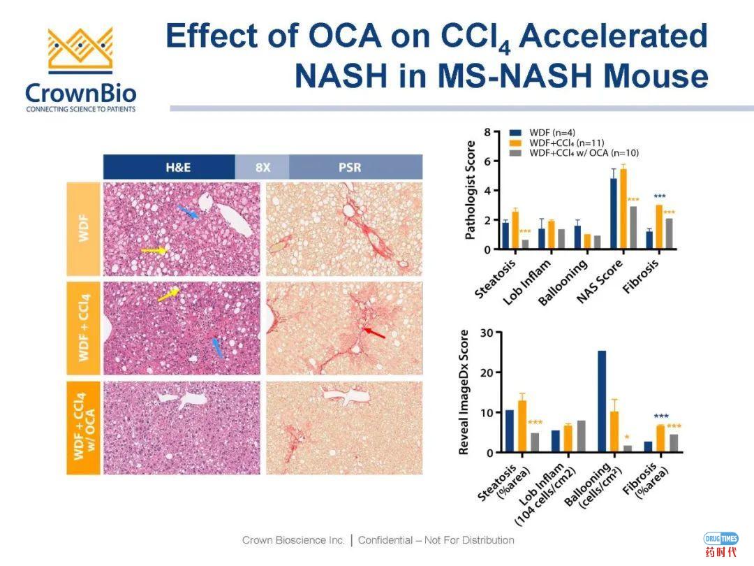 药时代直播间|“NAFLD/NASH和纤维化转化性临床前动物模型:从啮齿类动物到非人类灵长类动物(NHP)”网络研讨会问题解答