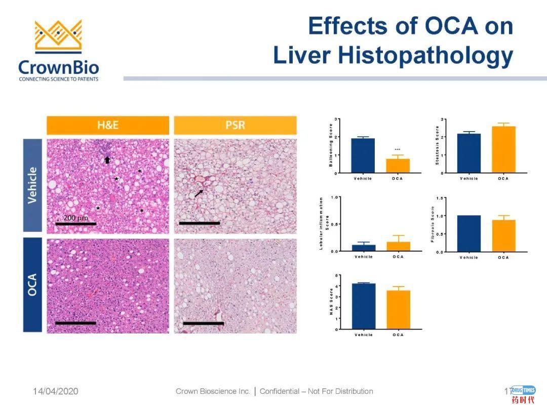 药时代直播间|“NAFLD/NASH和纤维化转化性临床前动物模型:从啮齿类动物到非人类灵长类动物(NHP)”网络研讨会问题解答