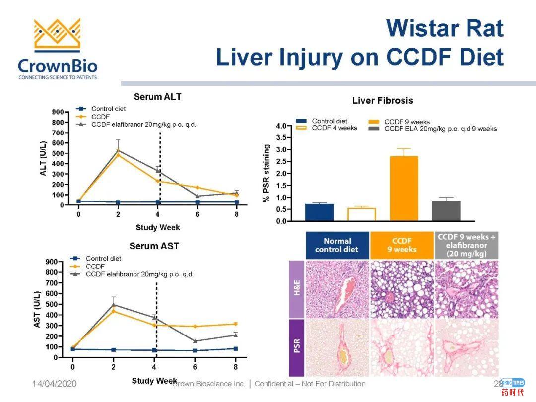 药时代直播间｜“NAFLD/NASH和纤维化转化性临床前动物模型：从啮齿类动物到非人类灵长类动物（NHP）”网络研讨会问题解答
