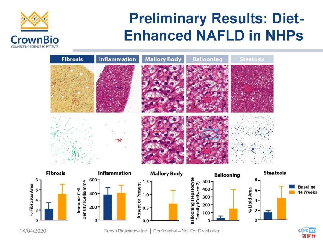 药时代直播间|“NAFLD/NASH和纤维化转化性临床前动物模型:从啮齿类动物到非人类灵长类动物(NHP)”网络研讨会问题解答