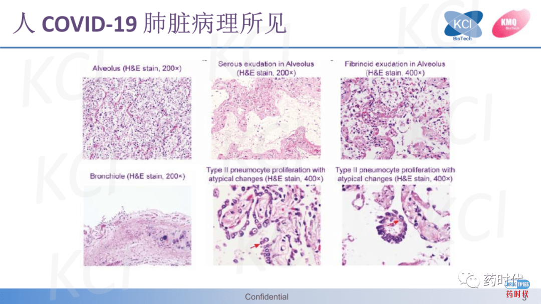 PPT分享 ｜ ​急性肺损伤与ARDS实验动物模型——从啮齿动物到兔的疾病模型比较