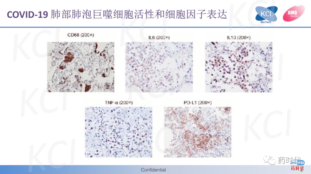 PPT分享 ｜ ​急性肺损伤与ARDS实验动物模型——从啮齿动物到兔的疾病模型比较