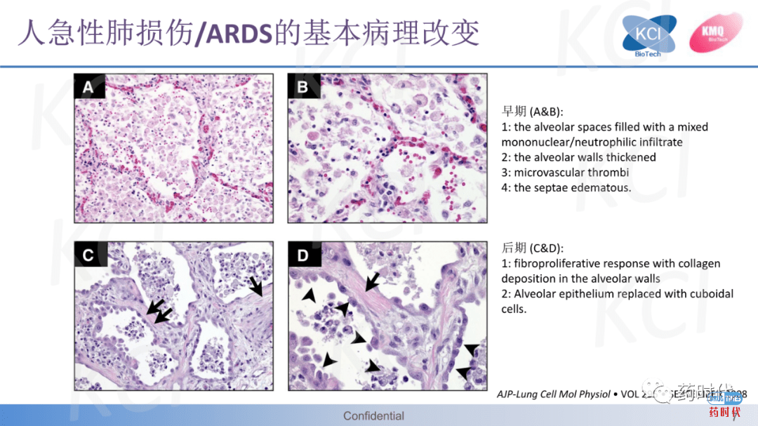 PPT分享 ｜ ​急性肺损伤与ARDS实验动物模型——从啮齿动物到兔的疾病模型比较