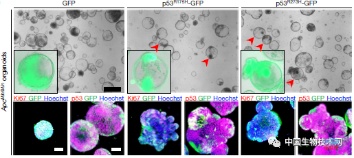 肠道环境“赐予”p53基因的两面派作用：抗癌or促癌