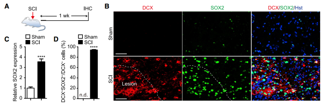 脊髓损伤不可逆? SOX2分子有新招！