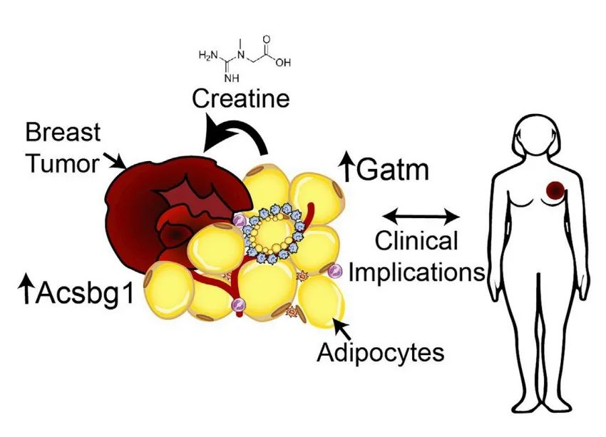 Cell Metabolism：肥胖导致乳腺癌详细机制被揭示