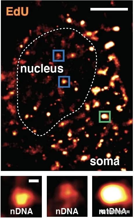 Science：将有限的DNA修复用在“刀刃”上，神经元会优先预防衰老和疾病！