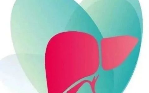 J Hepatol：一项大型美国中年队列NAFLD/NASH患病率的前瞻性评估