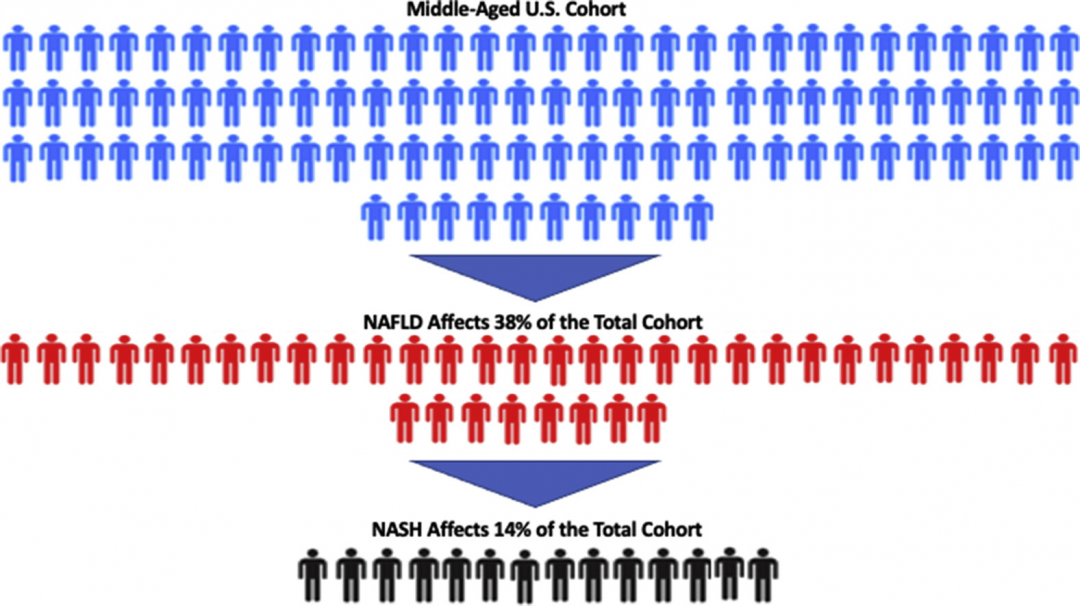 J Hepatol：一项大型美国中年队列NAFLD/NASH患病率的前瞻性评估