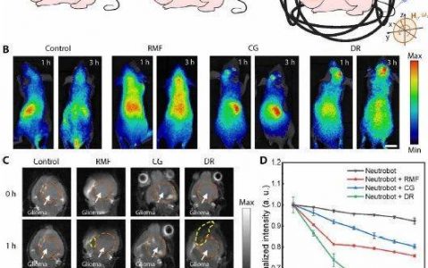 Science子刊：中性粒细胞微型机器人实现脑胶质瘤靶向给药