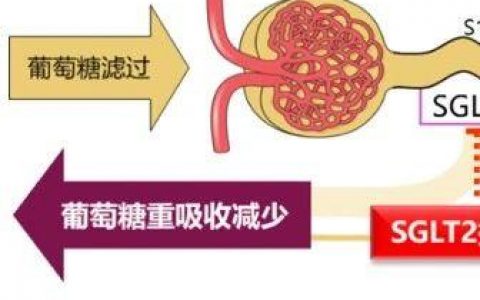 1、2型糖尿病均迎来新进展：支持批准、指南推荐、引进授权……