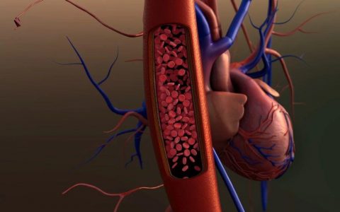 肥厚型心肌病首药，联拓药业Mavacamten临床试验申请获CDE受理