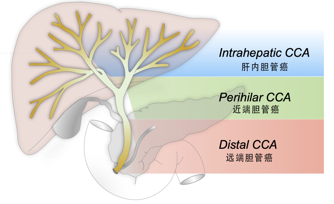 首款胆管癌靶向药，ASCO最新疗效数据令人惊喜！