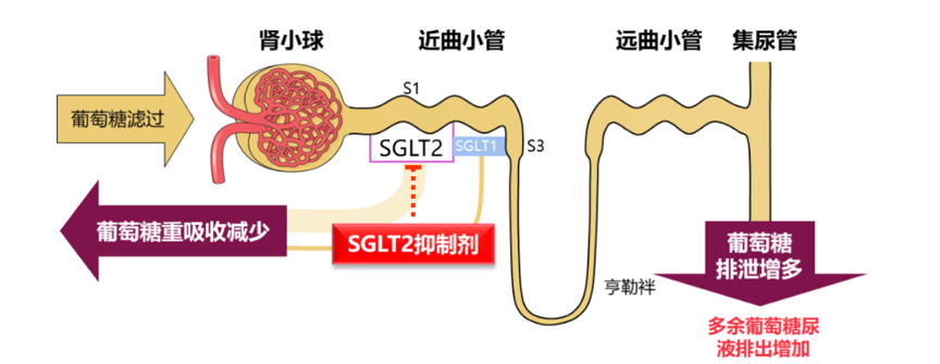 1、2型糖尿病均迎来新进展：支持批准、指南推荐、引进授权……