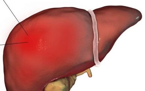 Nature：从基础研究到临床应用的典范，上海交大覃文新团队等发现肝癌新疗法
