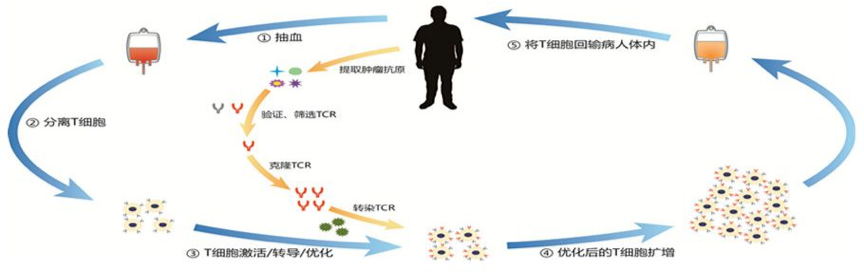 弥补CAR-T短板的TCR-T疗法获资本青睐，前景可期