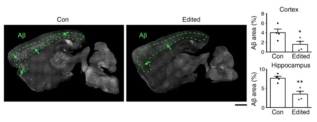 Nature子刊：CRISPR基因编辑，在阿尔兹海默症预防和治疗中潜力巨大