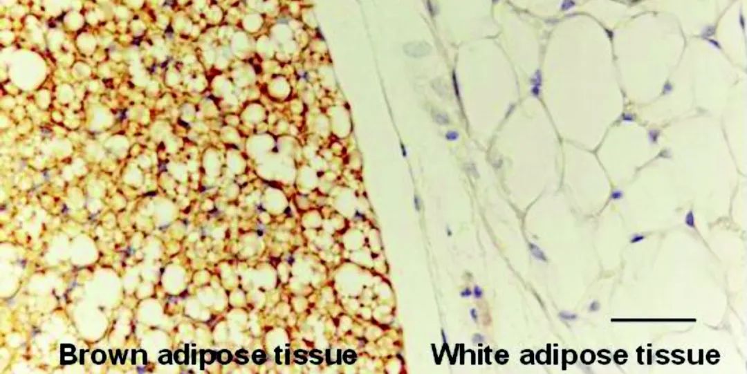 CRISPR基因编辑对肥胖下手了，改造白色脂肪细胞，治疗肥胖和糖尿病