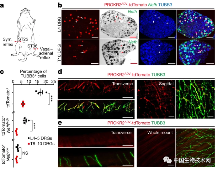 Nature“玩”起了针灸：哈佛大学团队证实“足三里”穴位可以治疗疾病