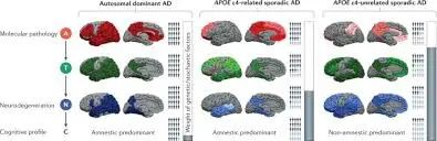 新框架：不是一种而是有三种形式的阿尔茨海默病