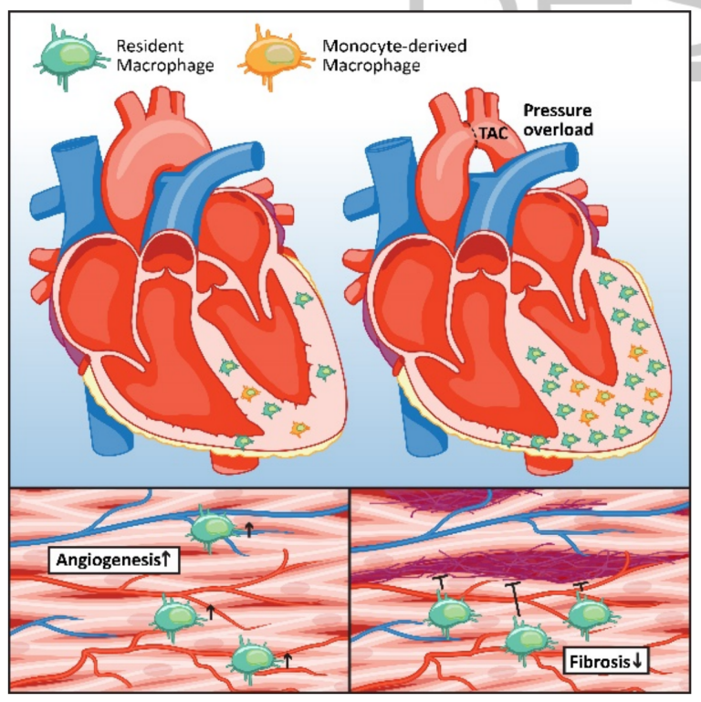 全球超6000万心力衰竭人群或将迎来治疗新希望！研究发现：心脏自身免疫细胞有心衰治疗潜力
