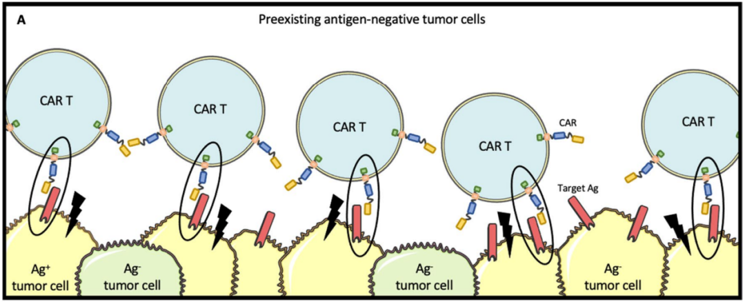 CAR-T细胞疗法如何达到100%长期治疗有效？解决这4个难点是关键